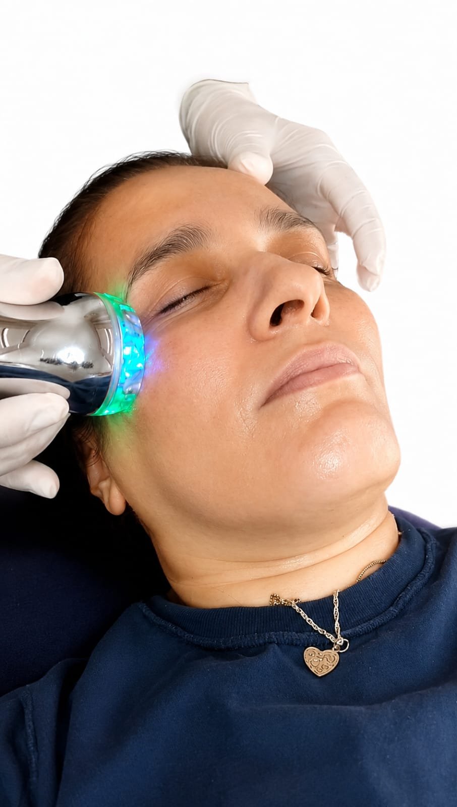 Dermoporación Facial